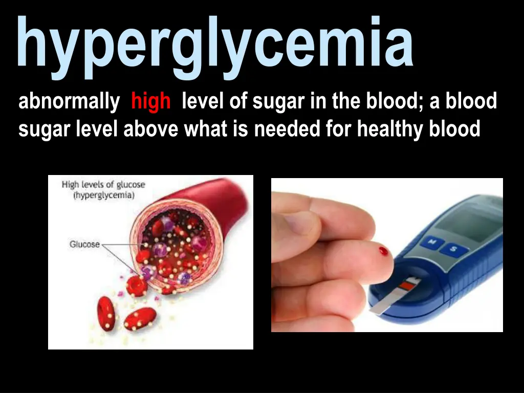 hyperglycemia abnormally high level of sugar