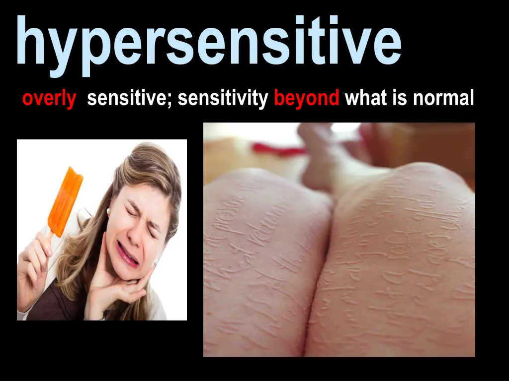 hypersensitive overly sensitive sensitivity