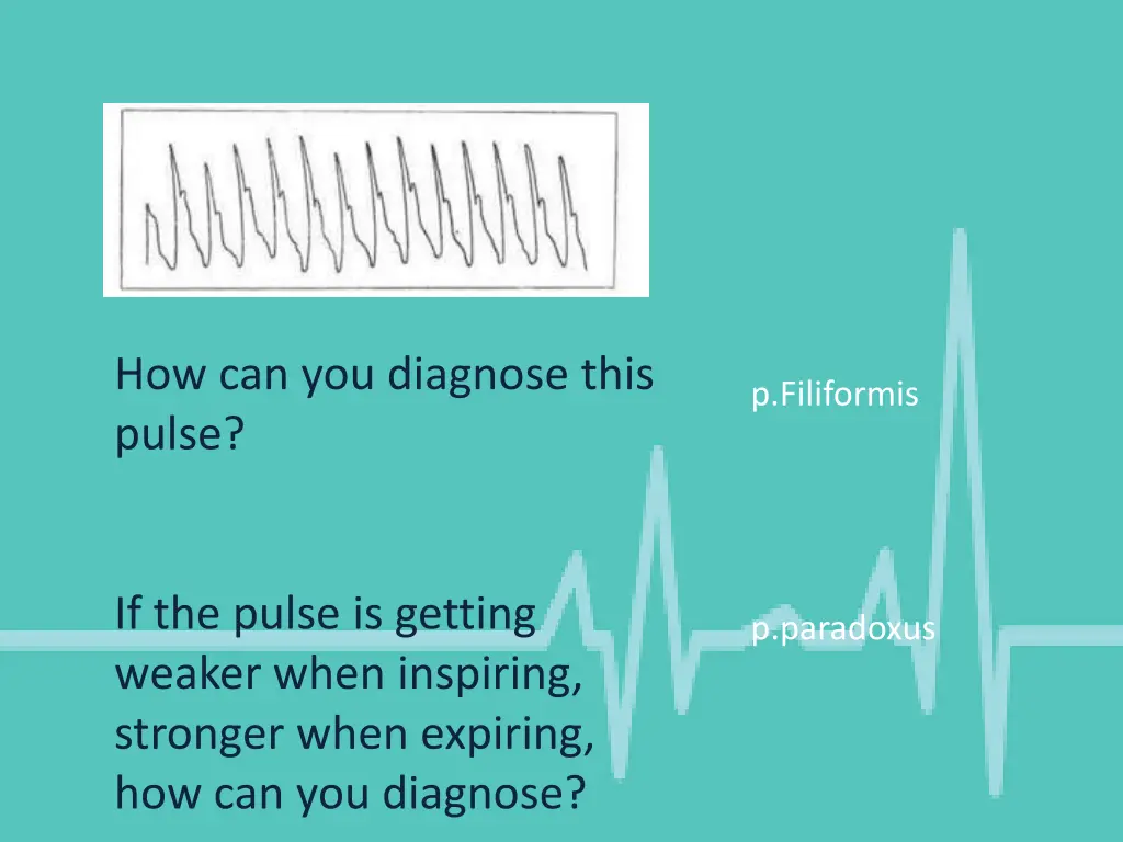 how can you diagnose this pulse