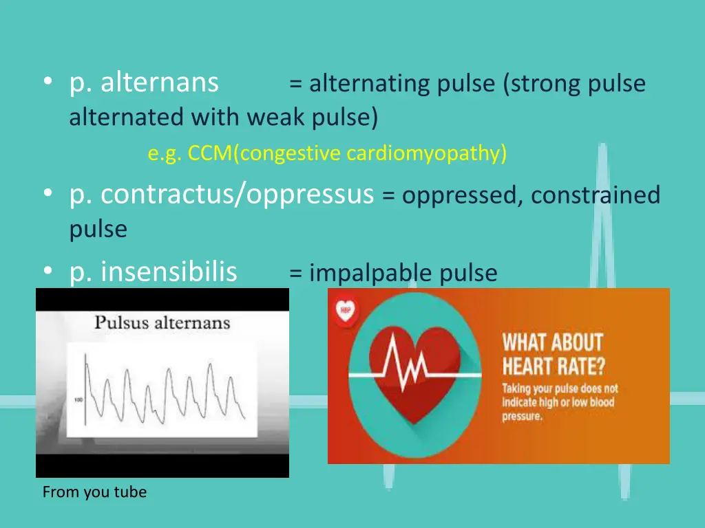 p alternans alternated with weak pulse