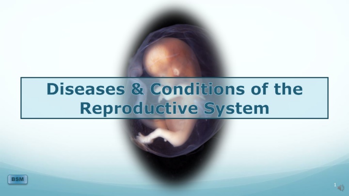 diseases conditions of the reproductive system