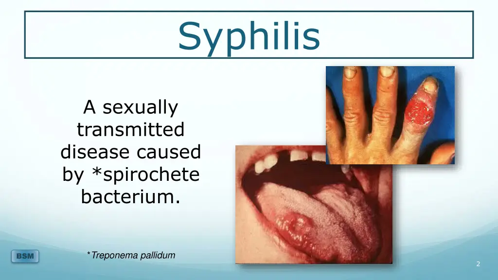 syphilis