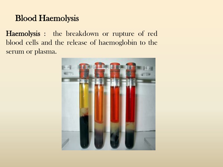 blood blood haemolysis haemolysis