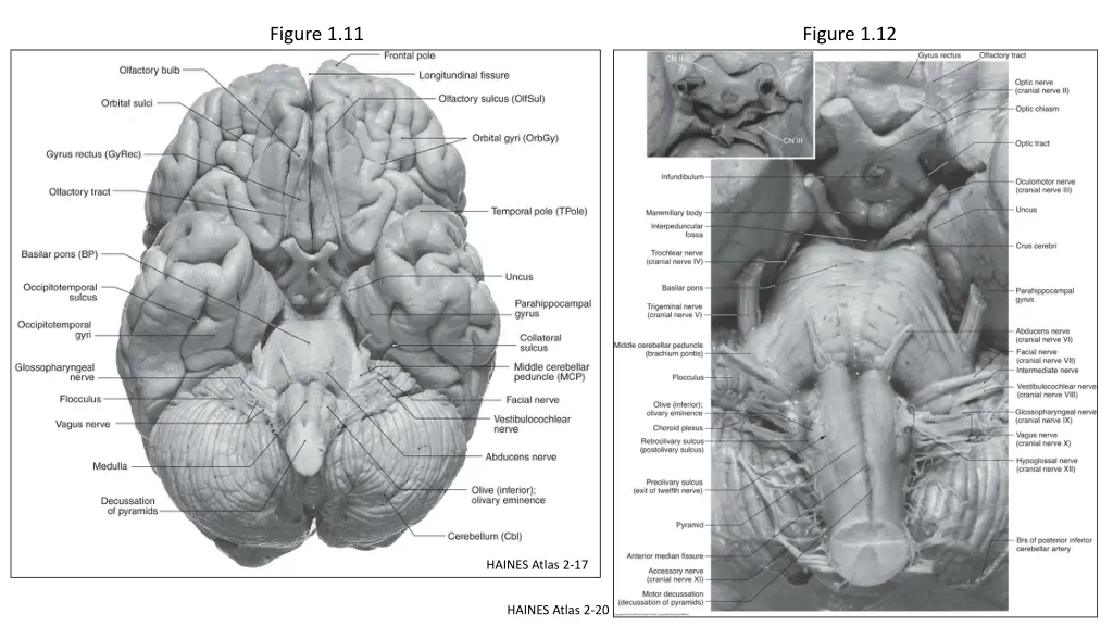 figure 1 11