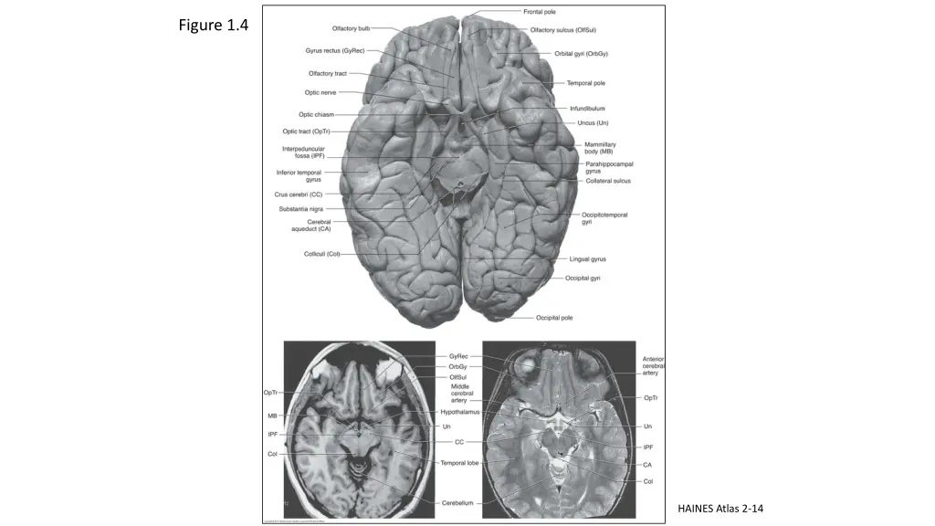 figure 1 4