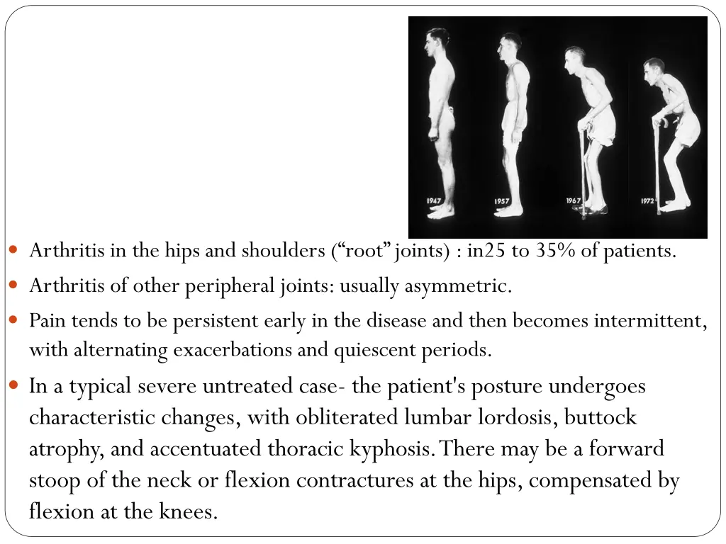 arthritis in the hips and shoulders root joints