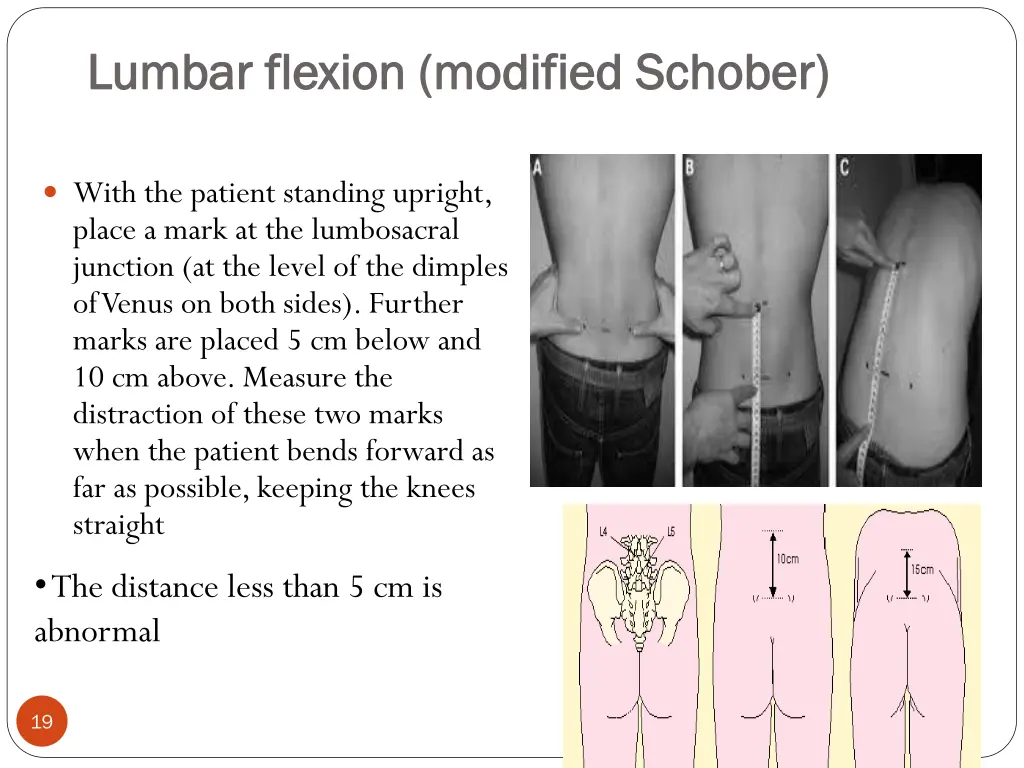 lumbar flexion modified lumbar flexion modified