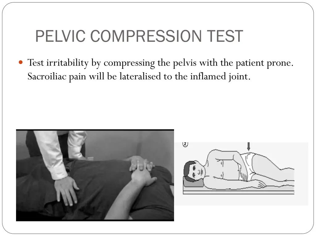 pelvic compression test