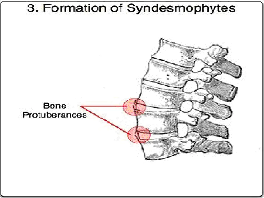 slide7