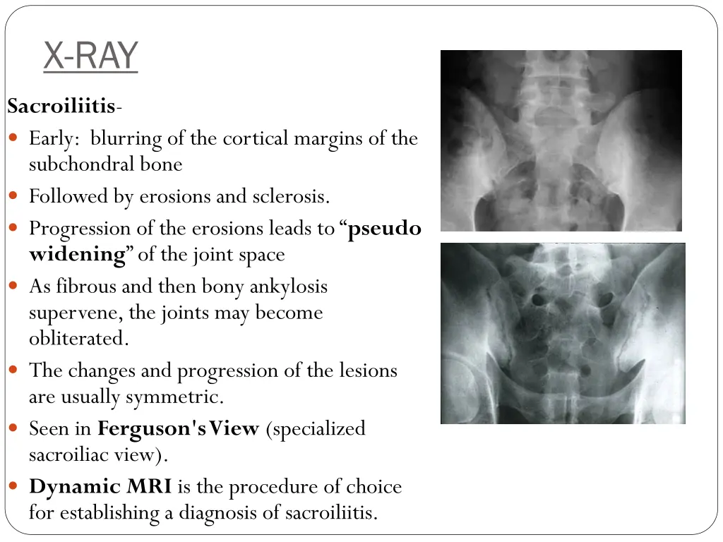 x ray