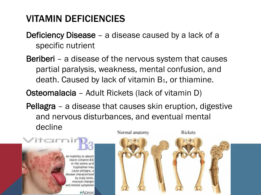 vitamin deficiencies