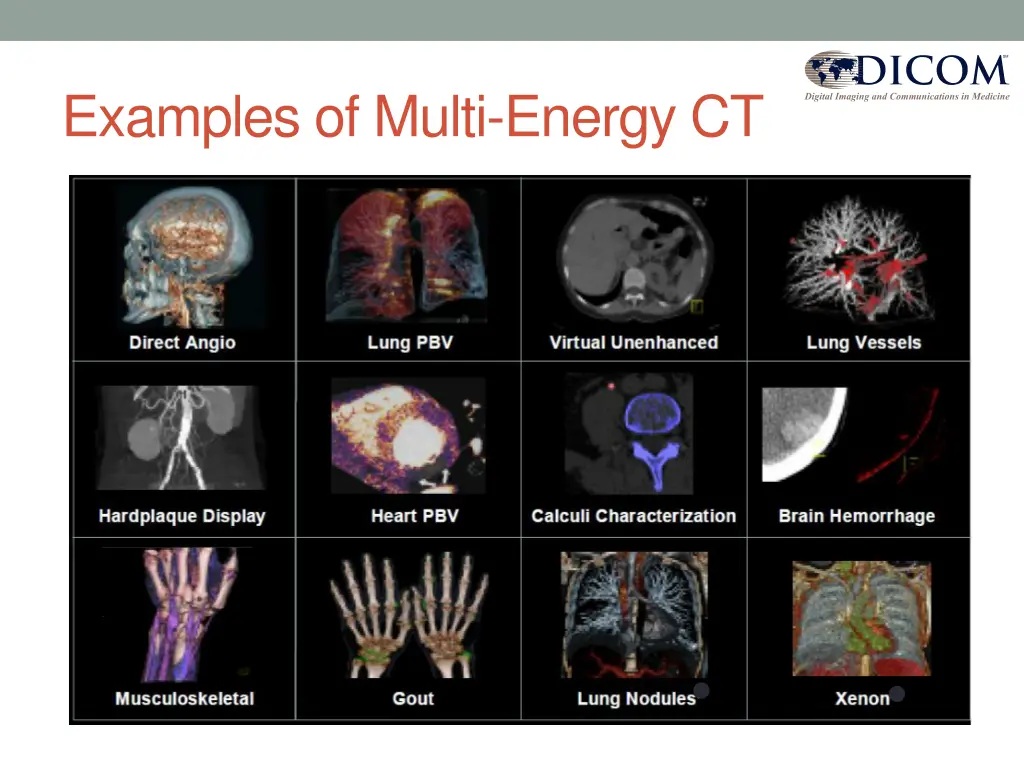 examples of multi energy ct