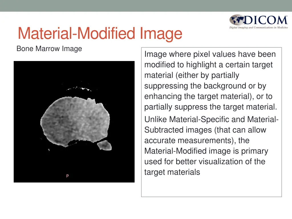 material modified image bone marrow image