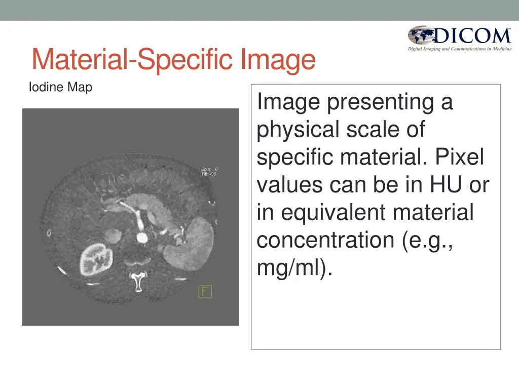 material specific image iodine map