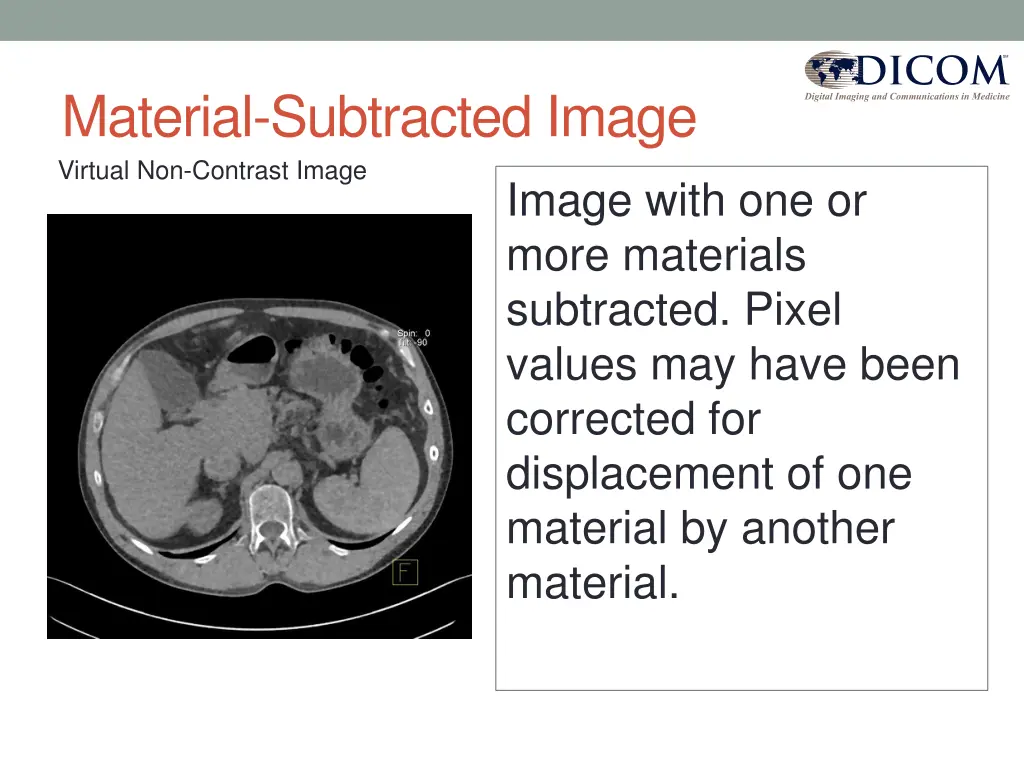 material subtracted image virtual non contrast