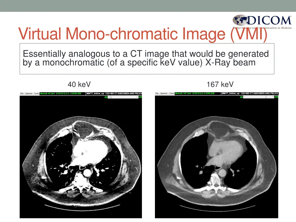 virtual mono chromatic image vmi