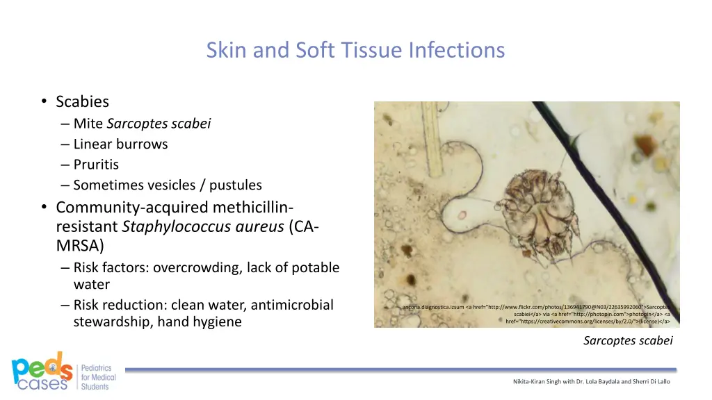 skin and soft tissue infections