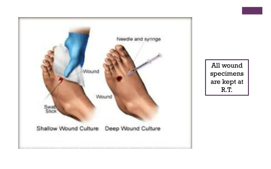 all wound specimens are kept at r t