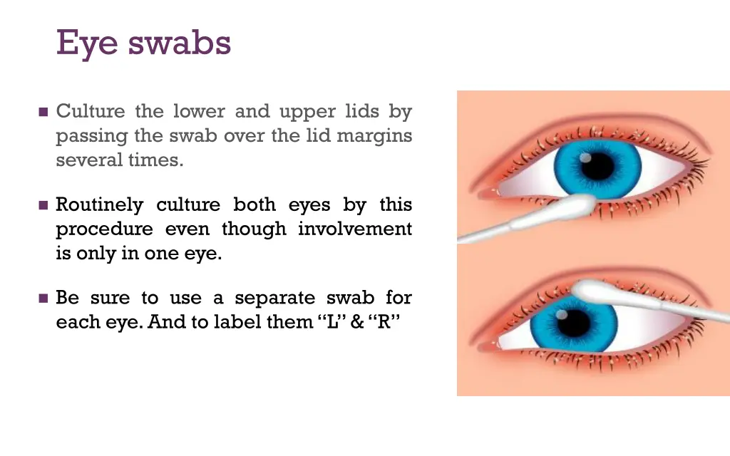 eye swabs