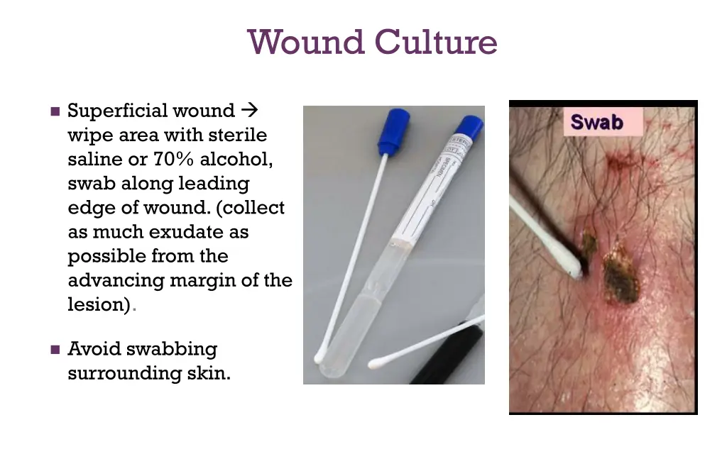 wound culture