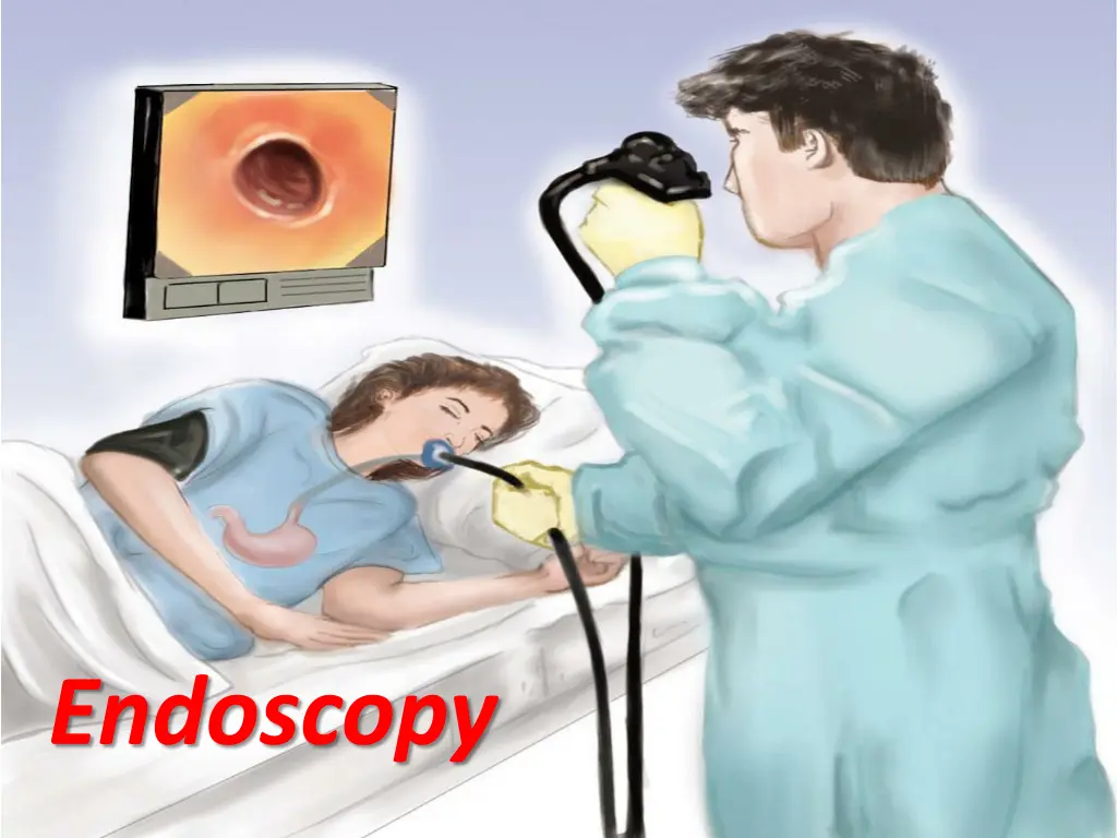 endoscopy