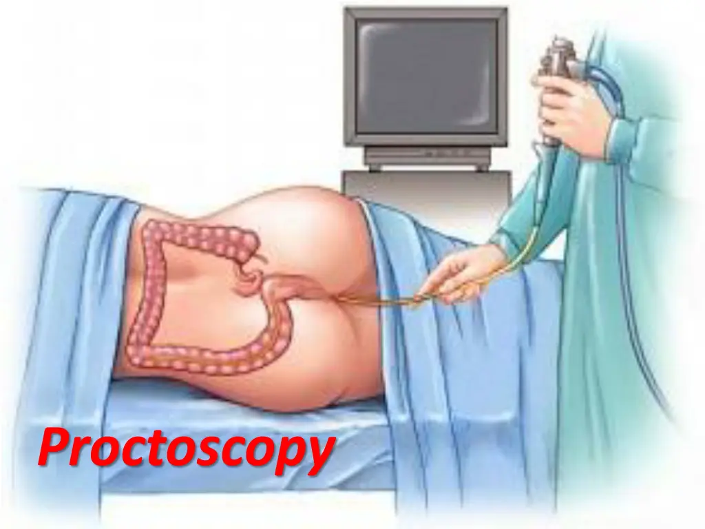 proctoscopy