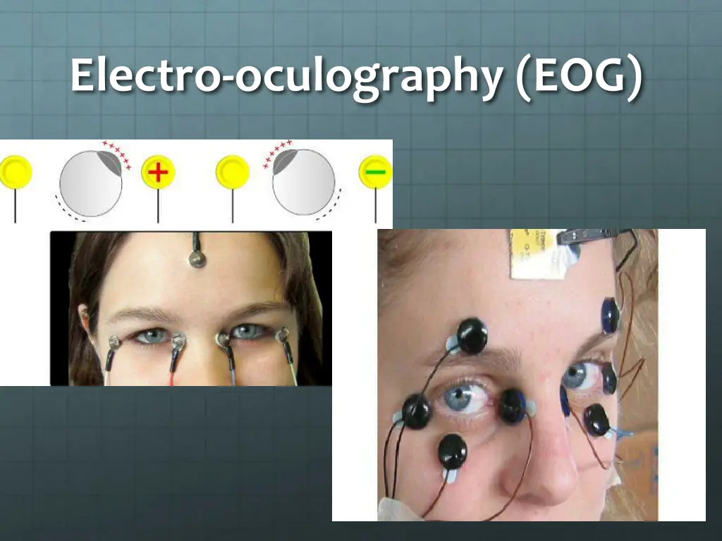 electro oculography eog