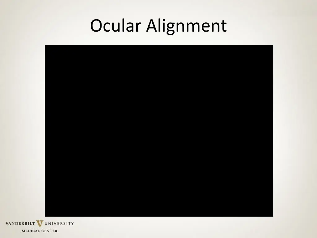 ocular alignment 1