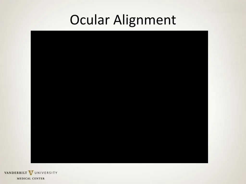 ocular alignment