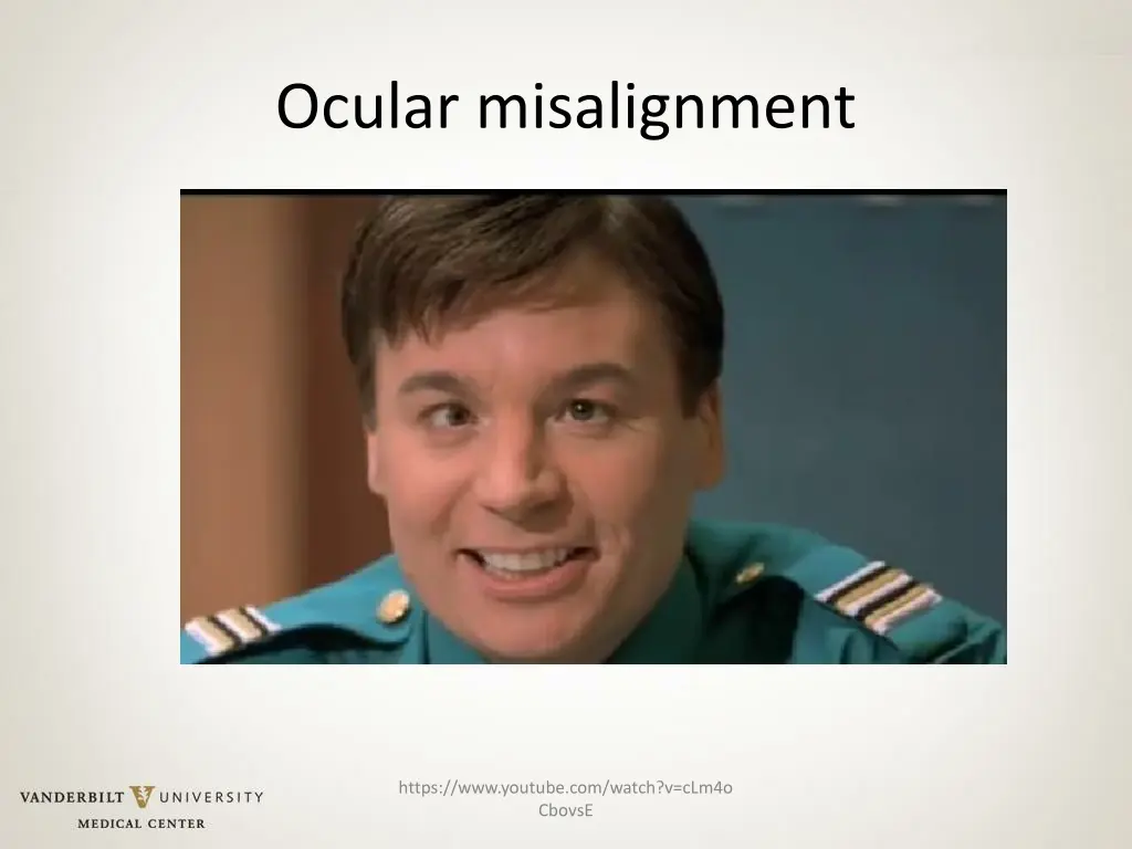 ocular misalignment 1