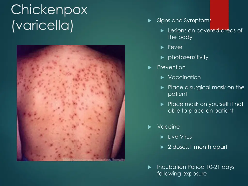 chickenpox varicella 1