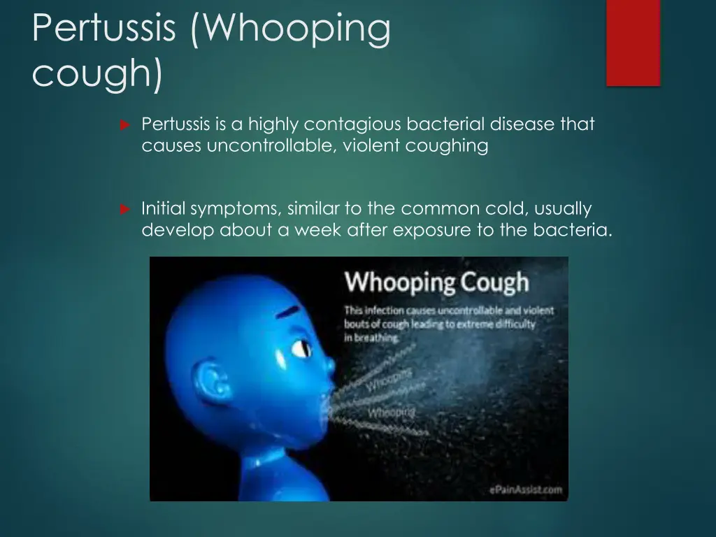 pertussis whooping cough