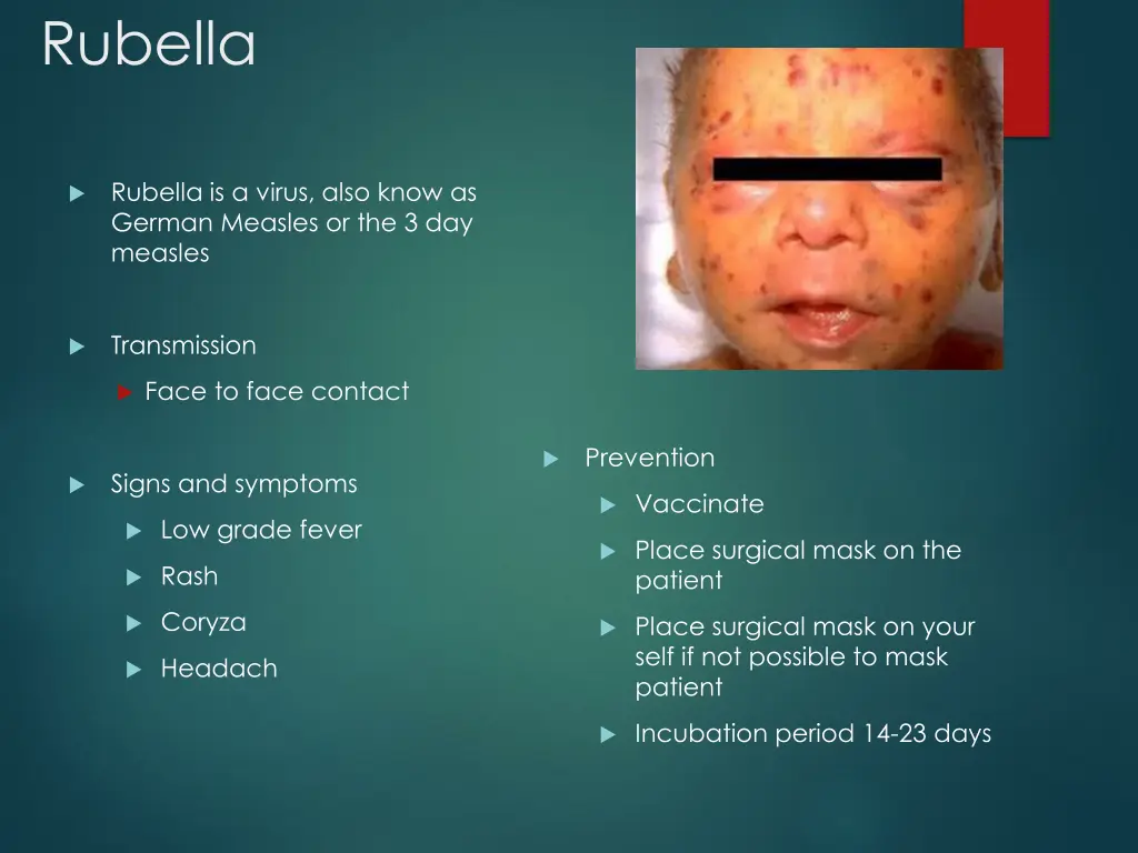 rubella