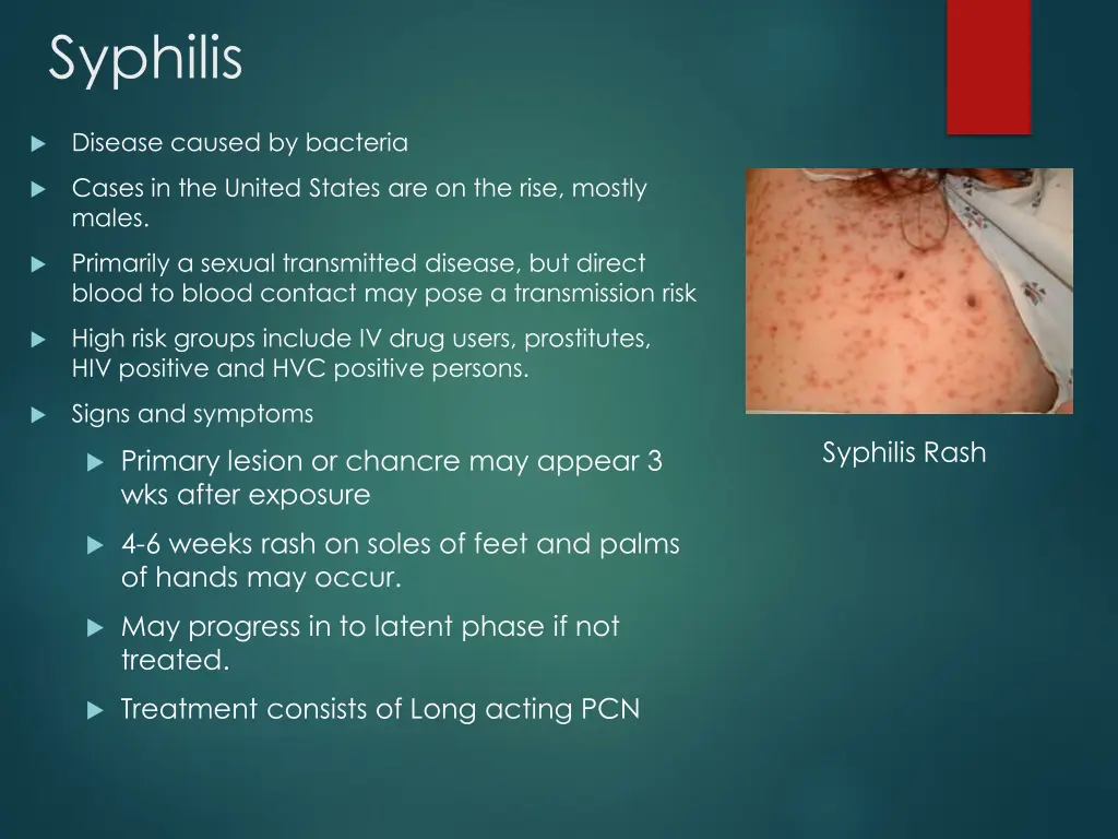 syphilis