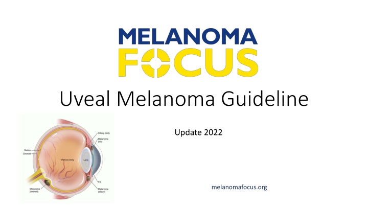 uveal melanoma guideline