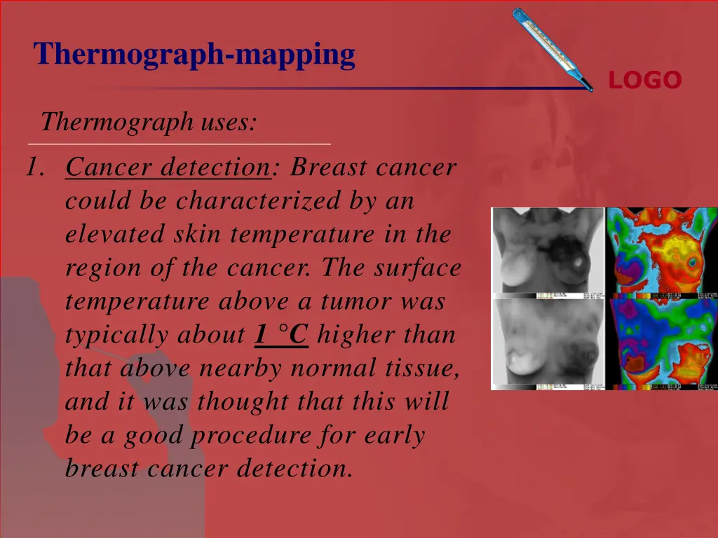 thermograph mapping 5