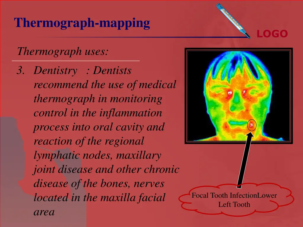 thermograph mapping 8