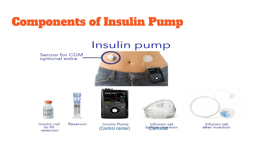 components of insulin pump