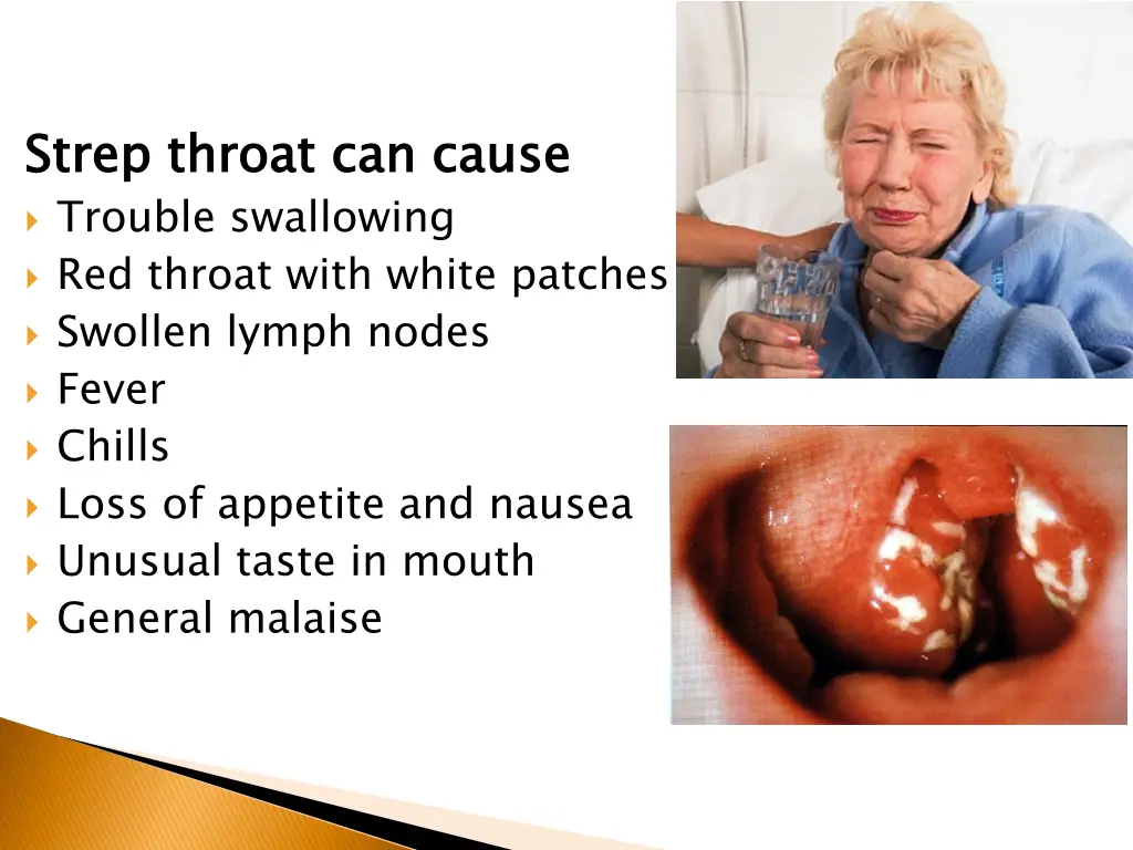 strep throat can cause trouble swallowing