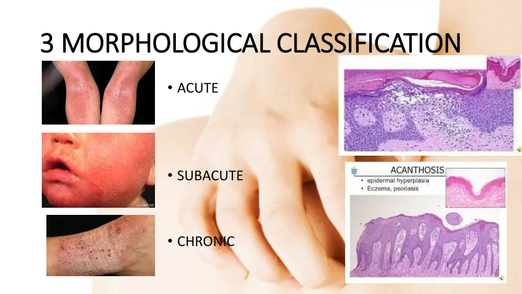 3 morphological classification 3 morphological