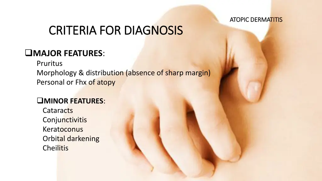 atopic dermatitis atopic dermatitis 4