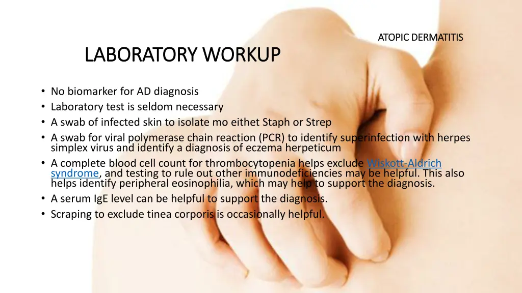 atopic dermatitis atopic dermatitis 5