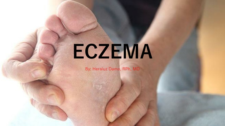 eczema