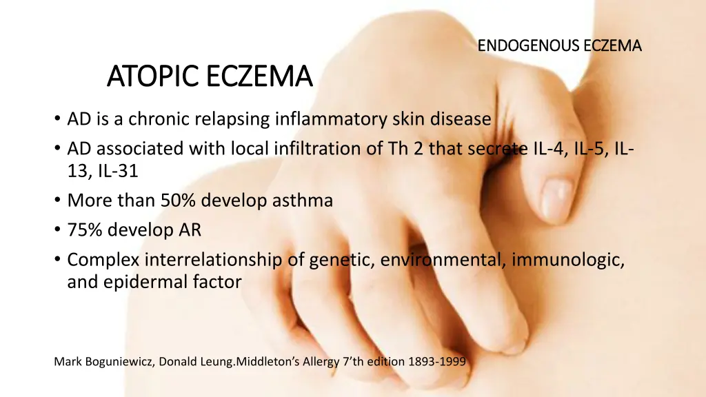 endogenous eczema endogenous eczema 1