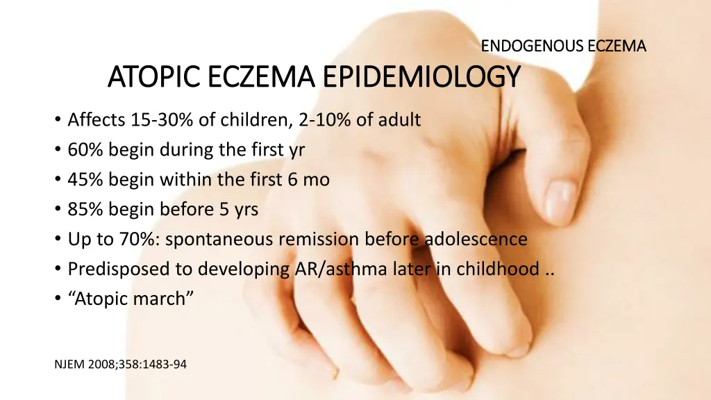 endogenous eczema endogenous eczema 2