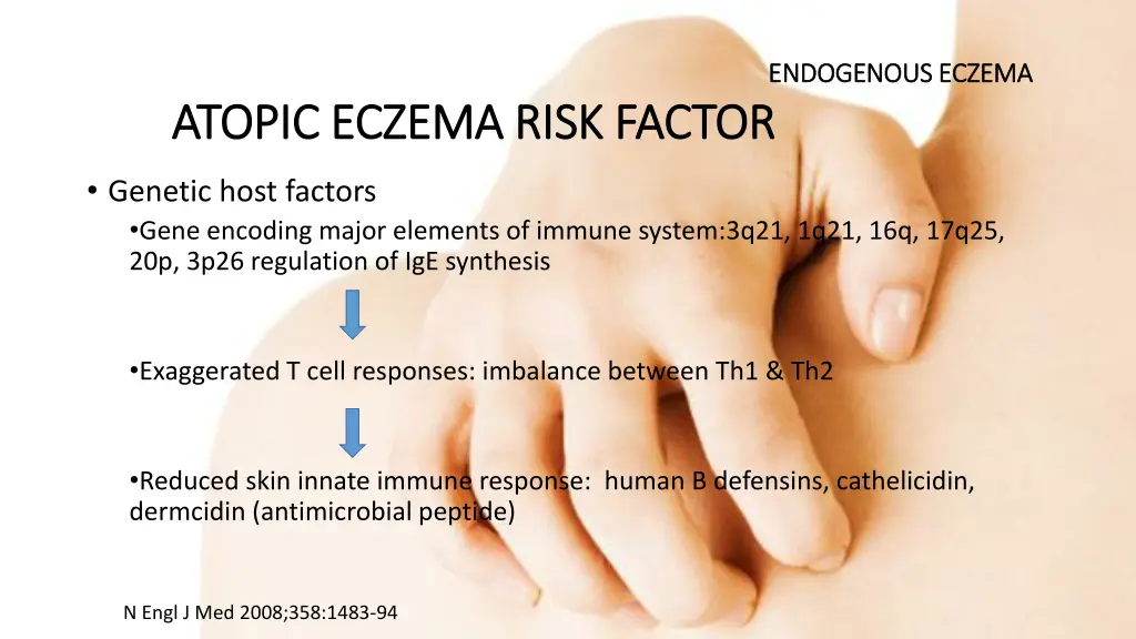 endogenous eczema endogenous eczema 5