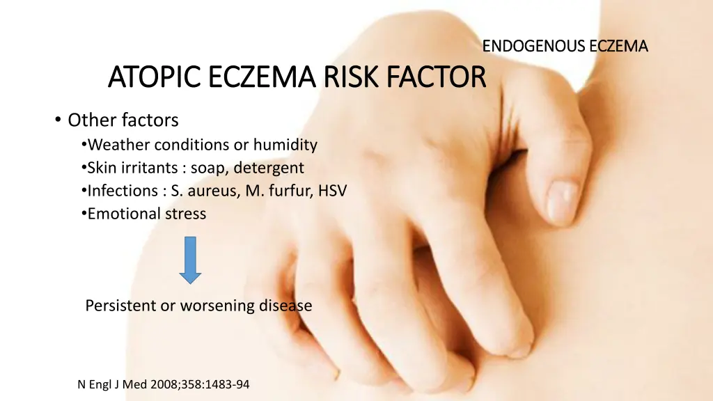 endogenous eczema endogenous eczema 7