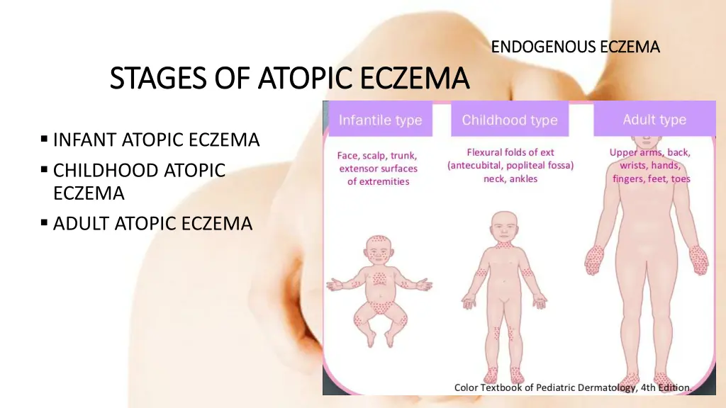 endogenous eczema endogenous eczema 9