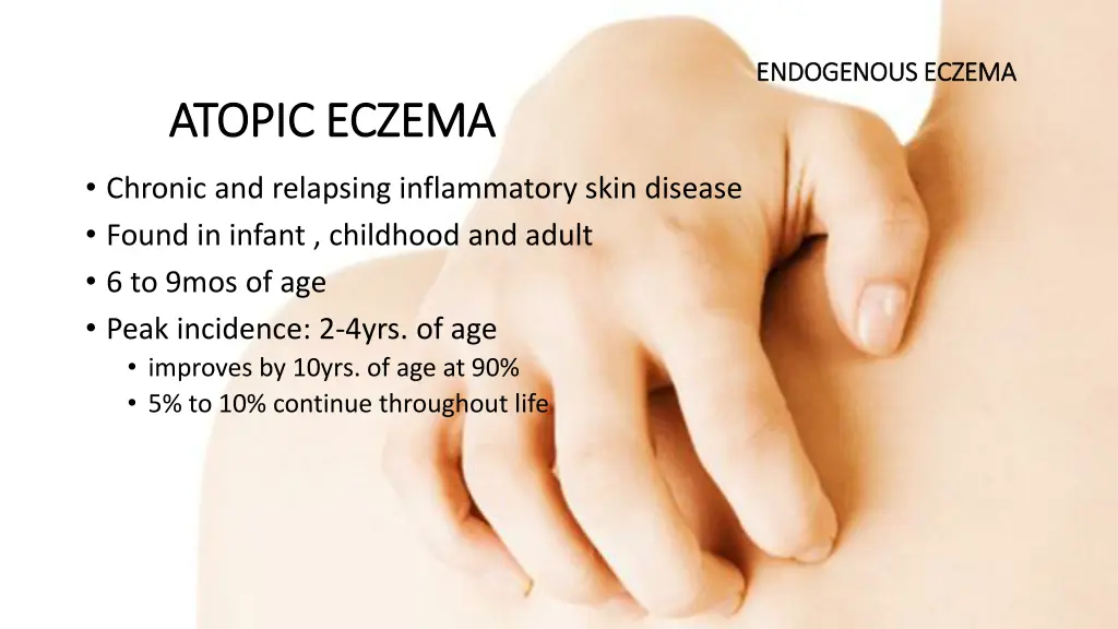 endogenous eczema endogenous eczema