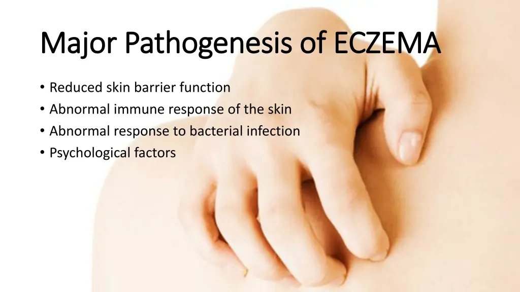 major pathogenesis of eczema major pathogenesis